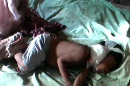 Sweeper turns surgeon in MP hospital