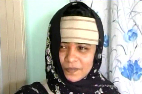 AP acid attack victim obtains distinction