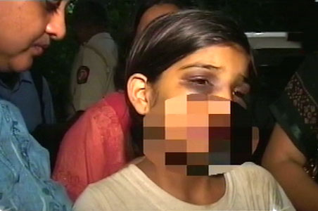 Ten-year-old tortured by employer in Mumbai