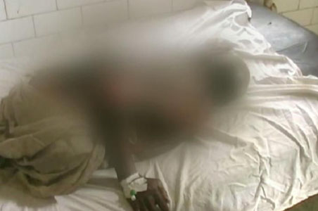 Dalit man set on fire in Madhya Pradesh
