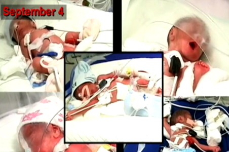 Mumbai's quintuplets