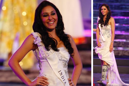 Injured Miss India is 'Beauty with a Purpose'