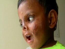 Bangalore's baby: Strangers helped him live and see Bangalore's baby: Strangers helped him live and see