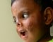 Bangalore's baby: Strangers helped him live and see