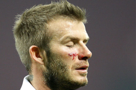 British poet laureate pens ode to injured Beckham 