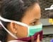 Fresh swine flu case in Hyderabad, patient's condition serious
