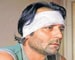 Man alleges torture by Mumbai cops, loses hearing