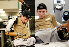 Soldier loses all 4 limbs in Iraq, walking again