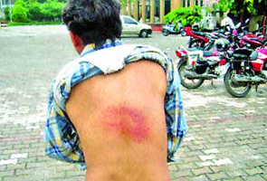 Man allegedly beaten with tyre tubes, lathis for demanding salary