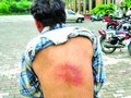 Man allegedly beaten with tyre tubes, lathis for demanding salary