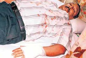 Man shot at on Pune street, gets no help from passersby Man shot at on Pune street, gets no help from passersby