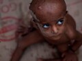 World's hungry population decreases but remains large