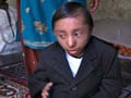 Nepalese teen becomes world's smallest man
