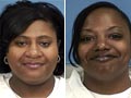 Sister must donate kidney to get out of US jail
