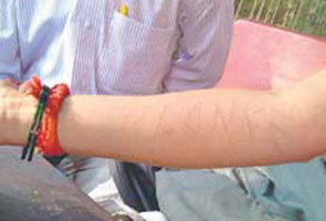 Pune man cuts wife's wrist, engraves his name on it