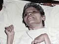 Supreme Court rejects Aruna Shanbaug's euthanasia plea