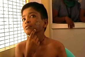 Teenage boy branded on cheek using hot iron in Tamil Nadu