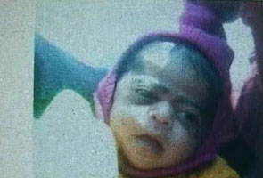 Five-month-old girl stolen from Delhi hospital