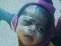 Five-month-old girl stolen from Delhi hospital