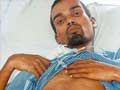 Man walks in Mumbai hospital with 6-ft rod through his abdomen