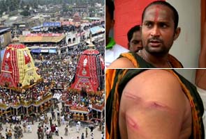 Priests lathicharged in Puri after overcrowding near chariots, 20 injured