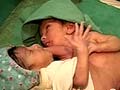 These conjoined twins need your help
