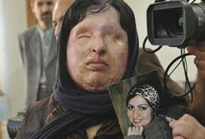 Iranian blinded by acid pardons her attacker 