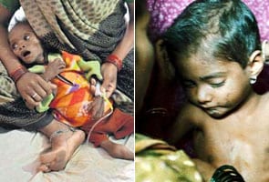450 kids starve to death in 4 months