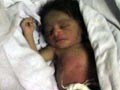 Two-day-old baby girl rescued after being buried alive