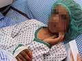Afghan child bride had fingernails pulled out