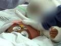 Have never seen a case like this, say doctors treating baby abused relentlessly