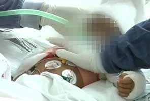 Baby Falak responding to treatment, taken off ventilator