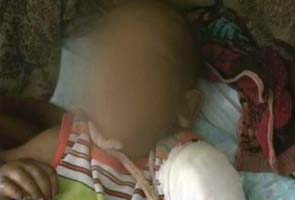 Tortured by stepfather, 3-year-old boy battles for life