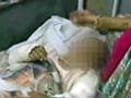 Jodhpur's battered boy recovering, say doctors