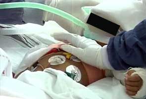 Baby Falak, age 2, dies of heart attack in hospital