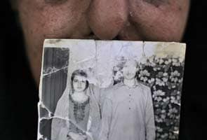 32 years after attack, Pakistani woman gets nose