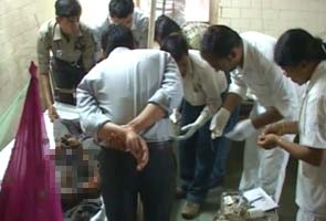 Minor girl gangraped, set ablaze by youths in MP