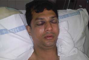 Mumbai road rage: NRI has skull fracture after being hit with baseball bat