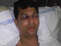 Mumbai road rage: NRI has skull fracture after being hit with baseball bat