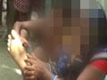 Bihar teen says JD(U) leader tortured him, hammered nails into his foot