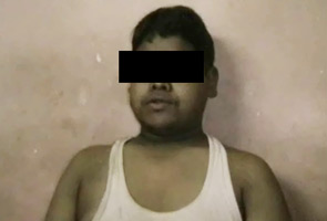 20-year-old allegedly tortured, maimed by beggar mafia in Mumbai