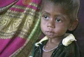 More than 24,000 Maharashtra children died of malnourishment in 1 year, says Govt report