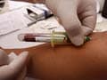 Hepatitis B threat stalks Bhutan