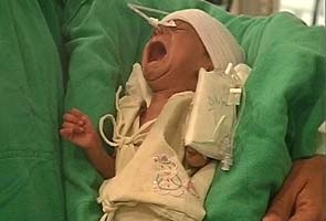 Damini, rickshaw puller's baby, discharged from hospital