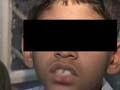 Child's teeth broken by upset teacher in Bangalore, allege parents