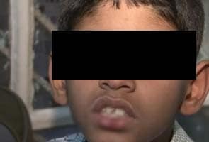 Child's teeth broken by upset teacher in Bangalore, allege parents