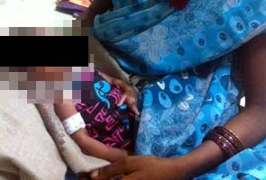 Parents allege baby mauled by cat in Hyderabad hospital, lost three fingers