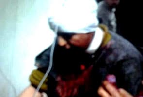 Woman panchayat member shot by suspected militants in Jammu and Kashmir