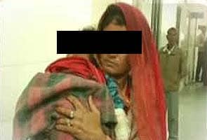 Bikaner baby who was bitten by her father on nose, lips dies in hospital