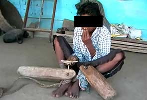 Mentally-challenged woman kept shackled by family after alleged rape